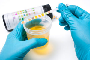Before You Try Urine Therapy Read This IMG 2377