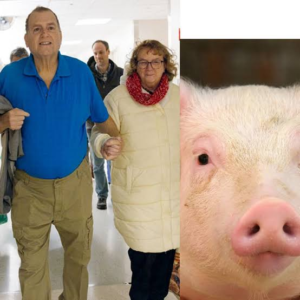 Pig Kidney Transplant Offers Man A Second Chance IMG 4171